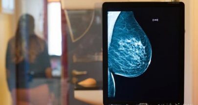 أمل جديد لمريضات سرطان الثدي بتحويل الخلايا المصابة إلى دهون image