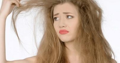 هل يمكن أن تؤثر رطوبة الجو على الشعر؟ image