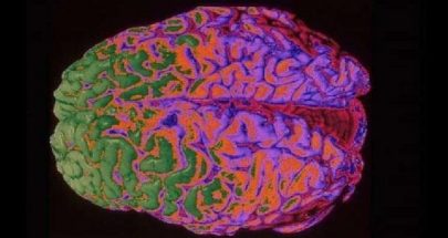 العلماء في طريقهم إلى ابتكار دماغ واع image
