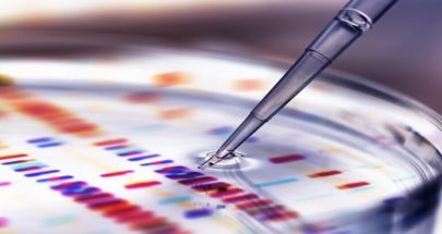 وزارة الصحة أجرت 84 فحص PCR في قبريخا image