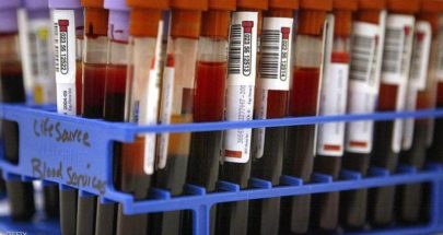 دراسة تكشف فصيلة الدم الأكثر مقاومة لكورونا image