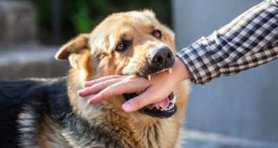 نقيب الأطباء البيطريين: للالتزام بارشادات وزارتي الصحة والزراعة بشأن داء الكلب image