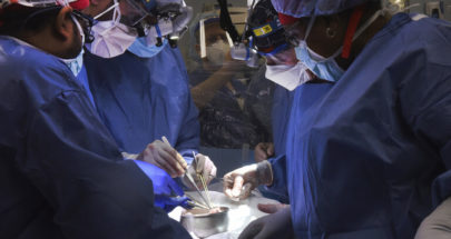 جراحون يزرعون بنجاح قلب خنزير في جسم إنسان في أول عملية من نوعها image
