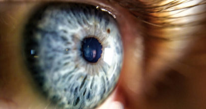 لون عينيك قد يحدد خطر الإصابة بمشكلات صحية image