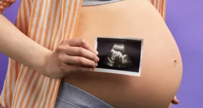 آمنة وغير مكلفة.. تقنية جديدة لاختيار جنس الجنين image