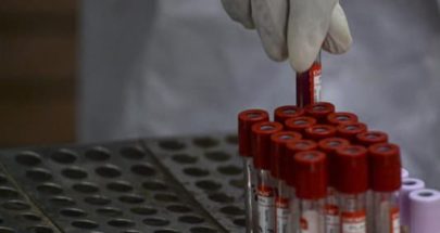 نتائج واعدة: اختبار دم قد يكشف عن 50 نوعاً من السرطان image
