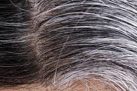 دراسة تكشف أسباب تحول الشعر إلى اللون الرمادي image