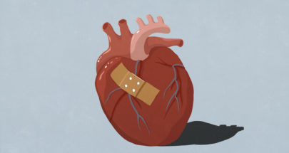 "رقعة من الأنسجة" لتصحيح عيوب القلب الخلقية عند الرضع image
