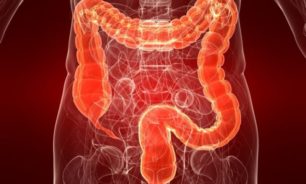 متلازمة "الأمعاء القصيرة" وأعراضها image