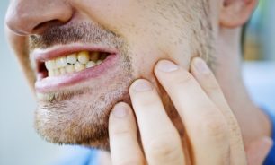 كيف يؤثر التوتر على صحة الأسنان؟ image